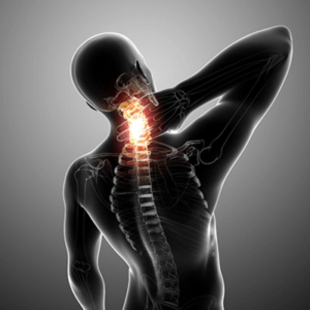imagem coluna vertebral Artrovida