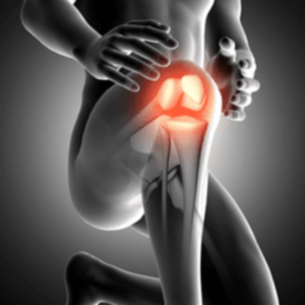 imagem Osteoartrite Artrovida